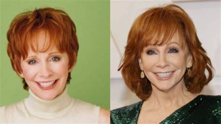 A Comprehensive Guide To Reba McEntire's Plastic Surgery Journey