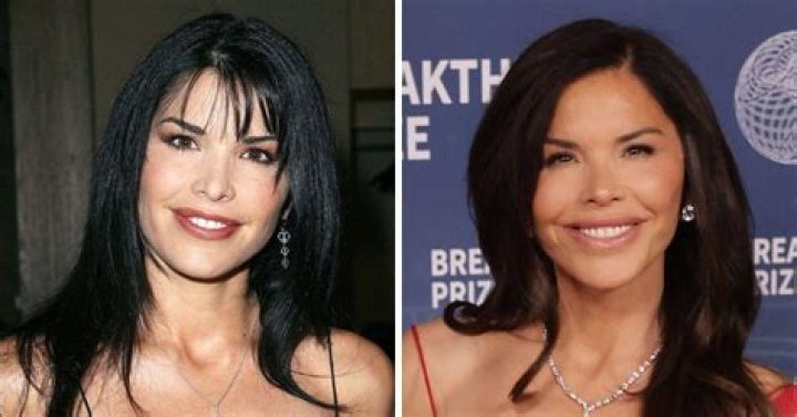Alanna Panday's Plastic Surgery Journey: Before And After