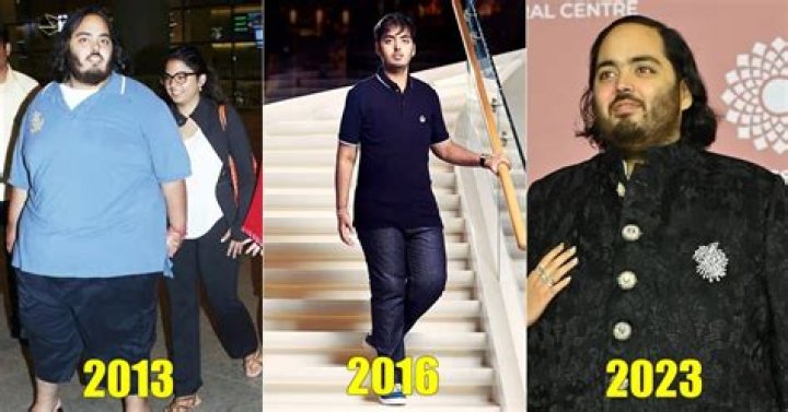Astounding Insights Into Anant Mukesh Ambani's Health Concerns