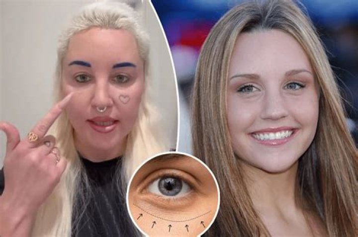 Cindy Jackson's Plastic Surgery Journey: Unraveling The Pursuit Of Perfection