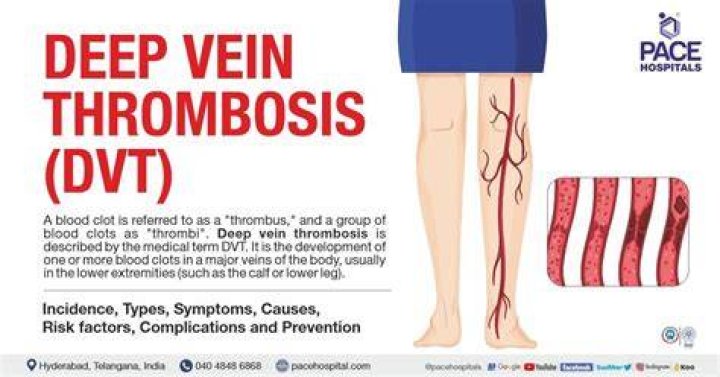 Comprehensive Guide To ICD-10 Codes For Suspected Deep Vein Thrombosis
