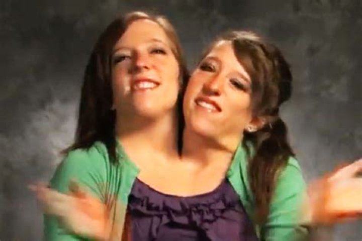 Conjoined Twins Abby And Brittany Hensel: An Inspiring Story Of 2021