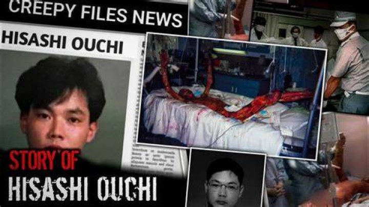 Discover Hisashi Ouchi's Final Image, Unveiling The Heartbreaking Truth