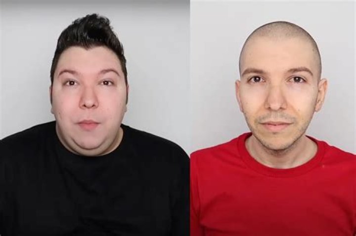 Discover Nikocado Avocado's Transformation: Before And After