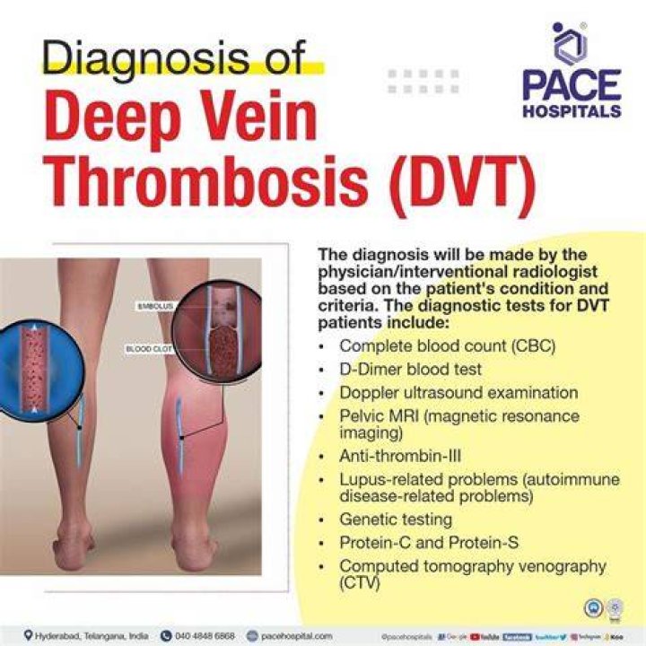 Essential Guide To Deep Vein Thrombosis (DVT) Leg: ICD-10 Codes Explained