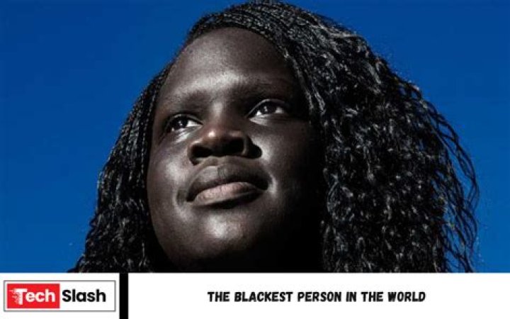 Get To Know The Extraordinary Blackest Person In The World
