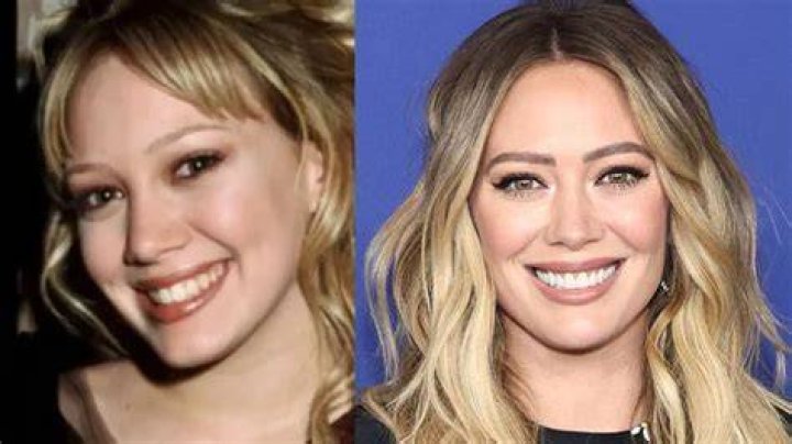 Hilary Duff had her teeth shortened ·