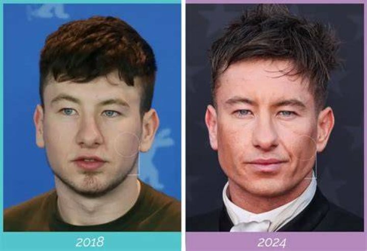 Is Barry Keoghan Asian? The Truth Revealed