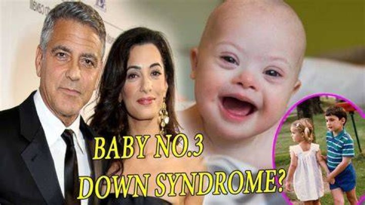 Is Down Syndrome Affecting George Clooney's Child?