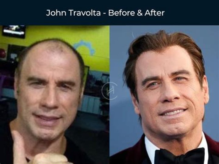 Jett Travolta: Life And Legacy Of The Son Of John Travolta