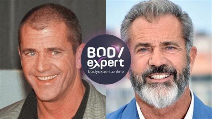 Kidney Transplant Celebrity