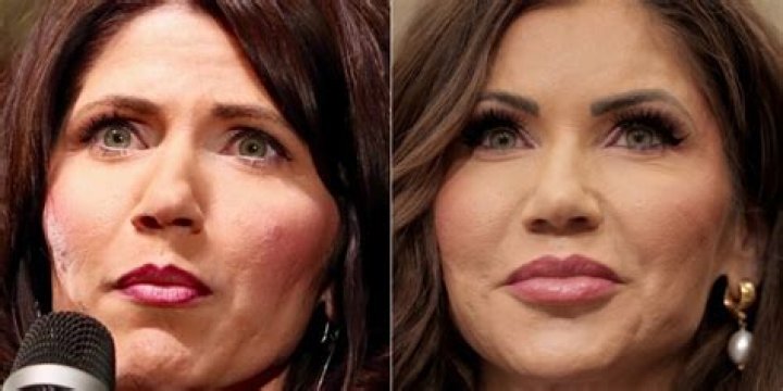 Kristi Noem's Plastic Surgery: Before And After Transformation