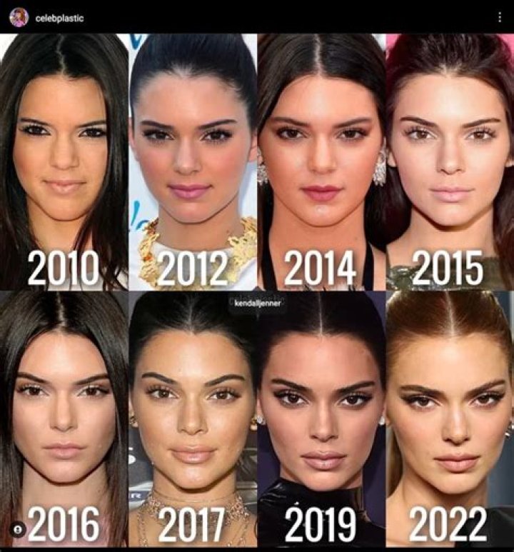 Kylie Jenner's Transformation In 2024