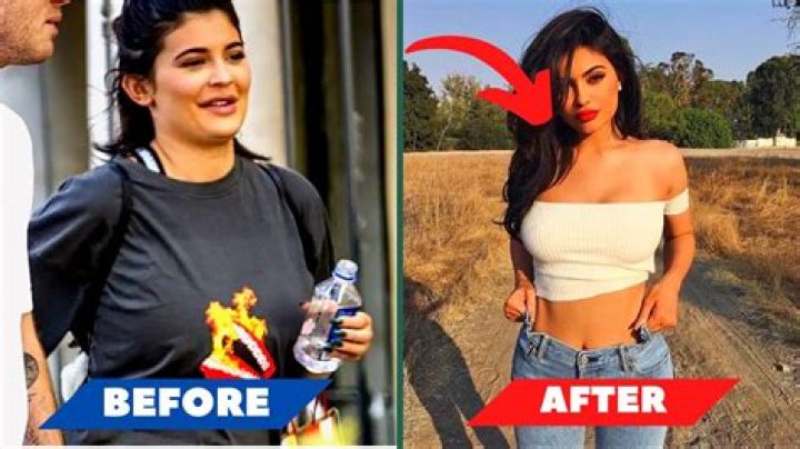 Kylie Jenner's Weight Loss Journey