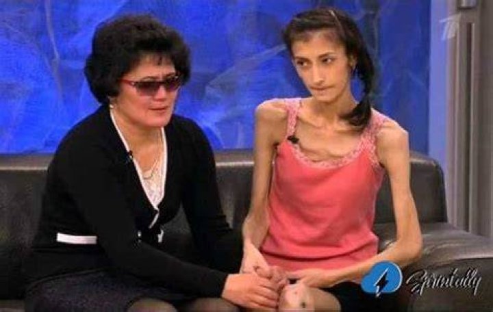 Meet The Remarkable 'World's Skinniest Lady'