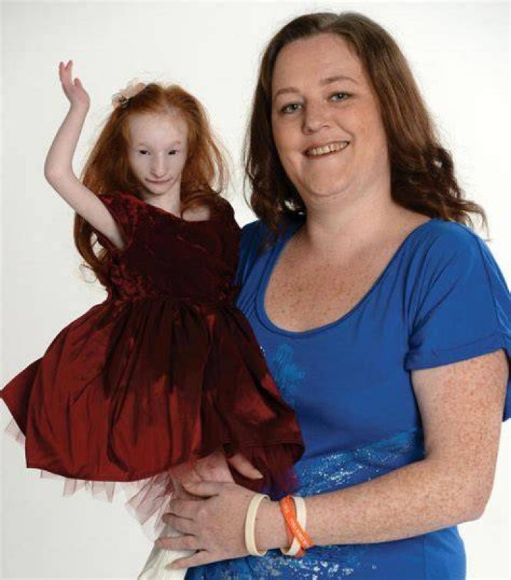 Meet The World's Tiniest Girl: An Extraordinary Tale Of Resilience