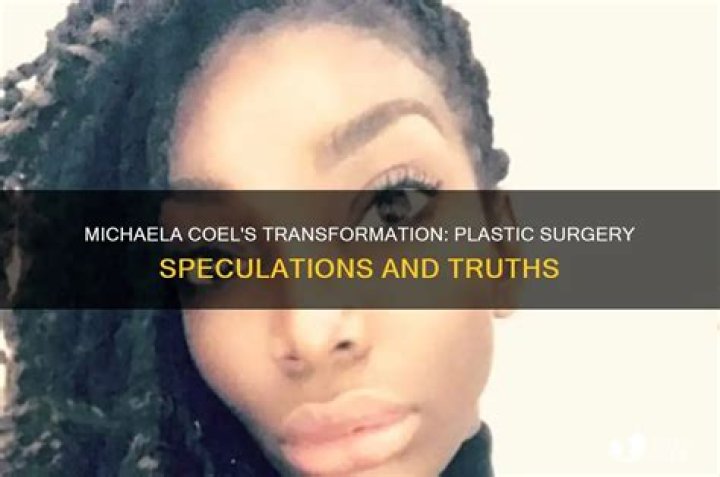 Michaela Coel's Plastic Surgery: Exploring Rumors And Facts