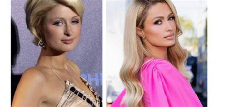 Paris Hilton's Nose Job: Uncovering The Enigma