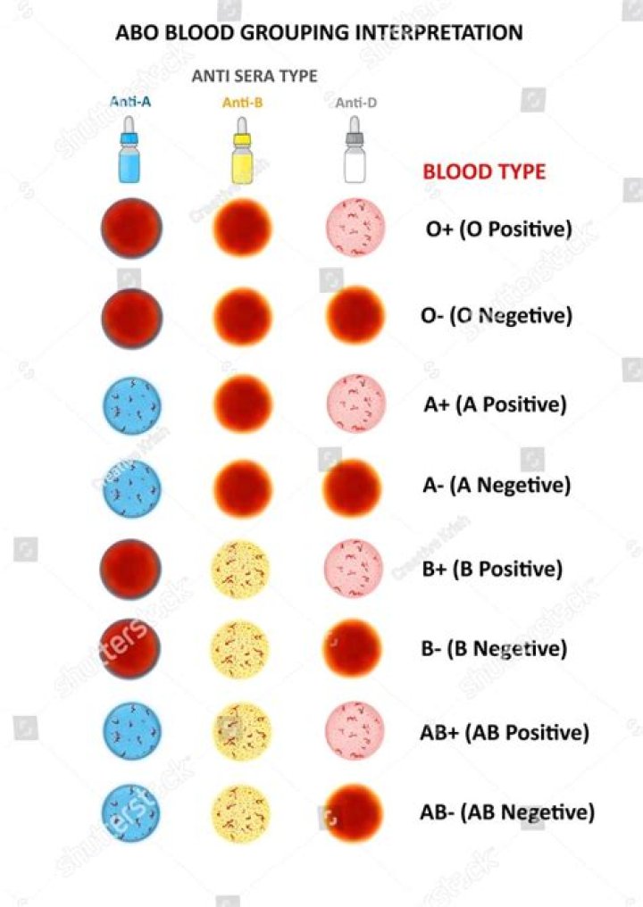 Sabrina Carpenter's Blood Type: Is It O-Positive Or Something Else?