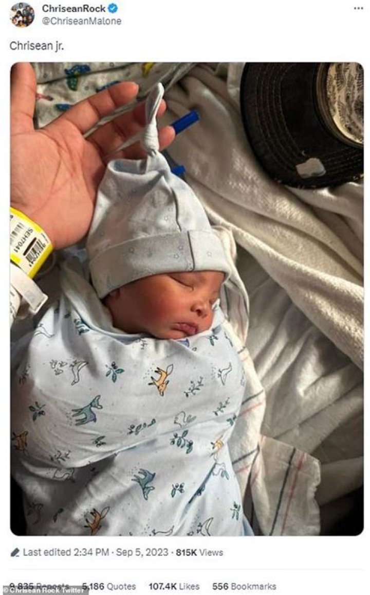 See Chrisean Jr.'s Shocking Hernia Photo