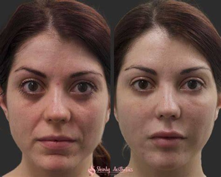 See The Before And After Faces