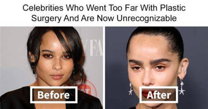Smokey Robinson's Journey With Plastic Surgery: A Candid Look