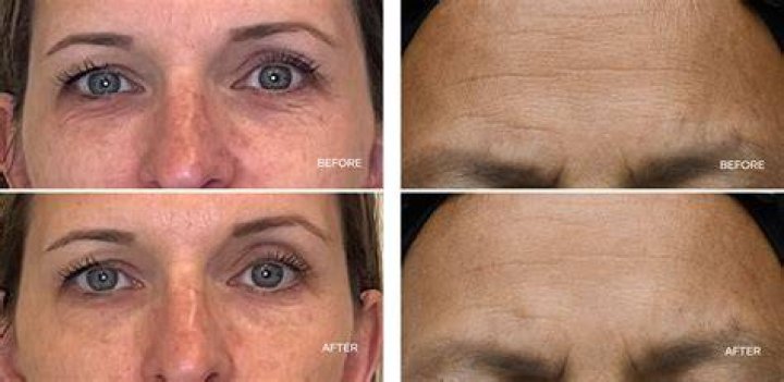 The Ageless Beauty And Her Journey To Youthful Radiance