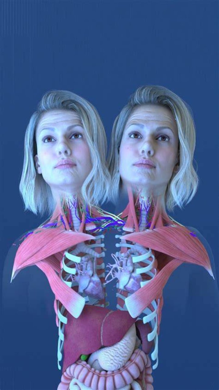 The Extraordinary Anatomy Of Abby And Brittany Hensel: A Biomedical Exploration