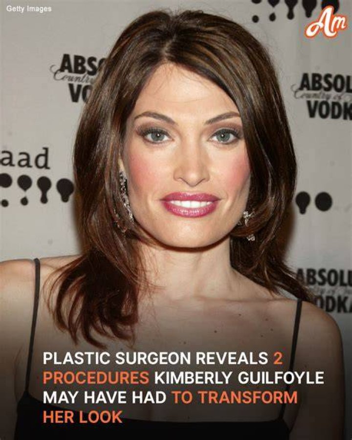 The Fascinating Age Of Kimberly Guilfoyle: Unveiled