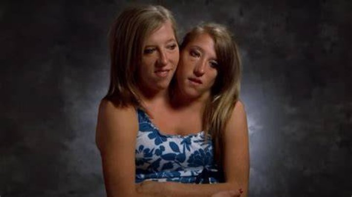 The Heartbreaking Family Loss Of Abby And Brittany Hensel: A 2021 Tragedy