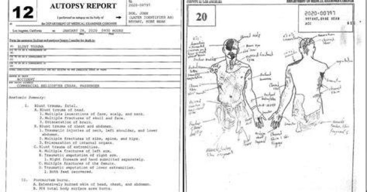The Tragic Autopsy Report Of Gianna Bryant