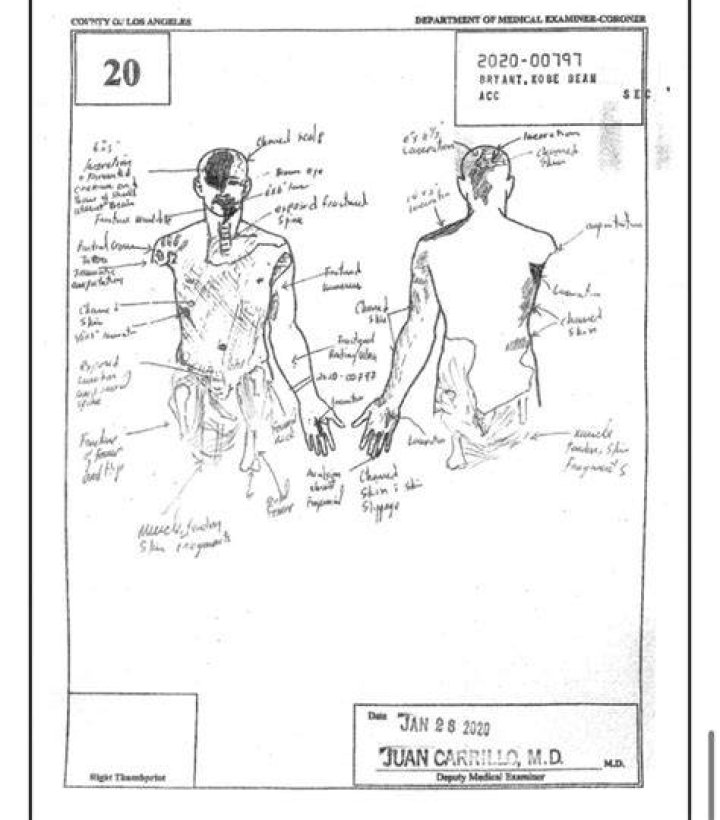 The Tragic Cause Behind Gianna Bryant's Death: Autopsy Report