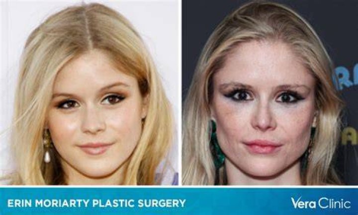 The Truth About Michaela Coel's Plastic Surgery Rumors