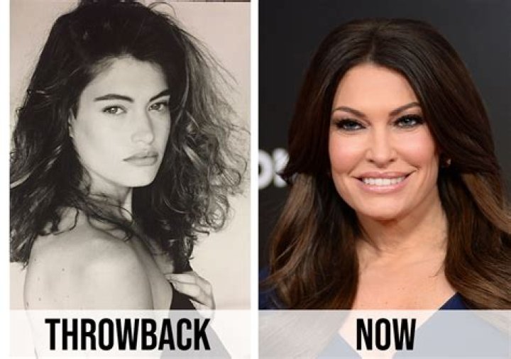 The Ultimate Guide To Kimberly Guilfoyle's Face Lift Procedure