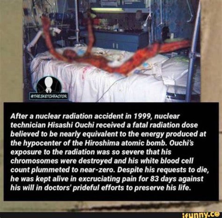 Tragedy Of Hisashi Ouchi: The Horrific Nuclear Accident