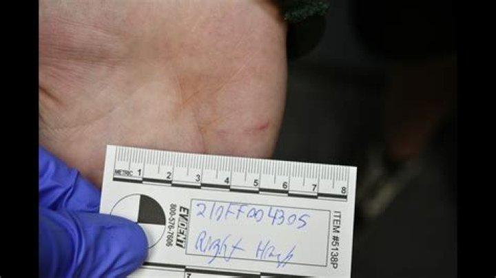 Tristyn Bailey Autopsy Results: Uncovering The Chilling Truth