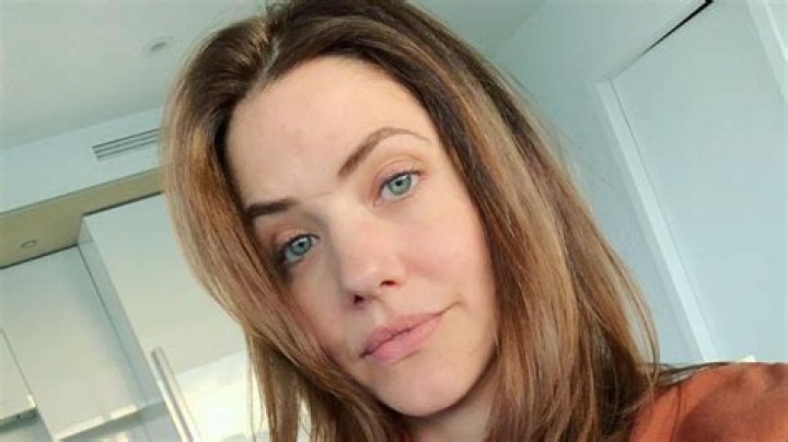 Ultimate Guide To Julie Gonzalo's Scar: History, Causes, And Significance