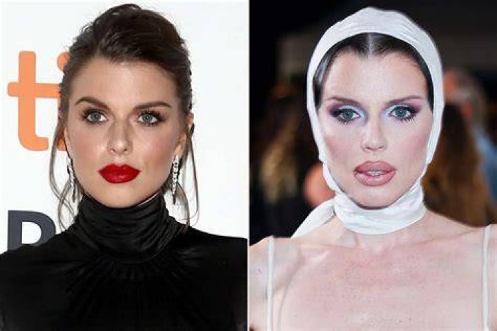Unbelievable Transformation: Blair White's Journey Before Surgery