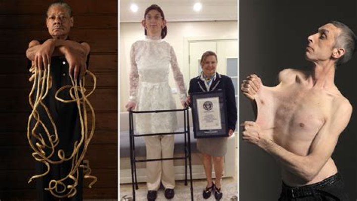 Uncover The Incredible Journey Of **The Slimmest Person In The World**