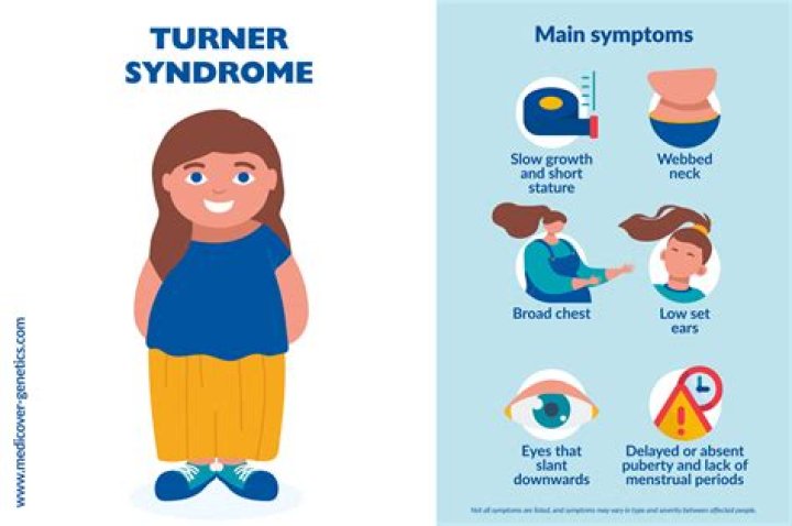 Uncovering Nicole Scherzinger's Journey With Turner Syndrome: An Inspiring Tale