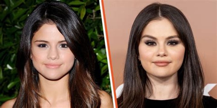 Uncovering The Truth: Did Selena Gomez Undergo Vocal Surgery?
