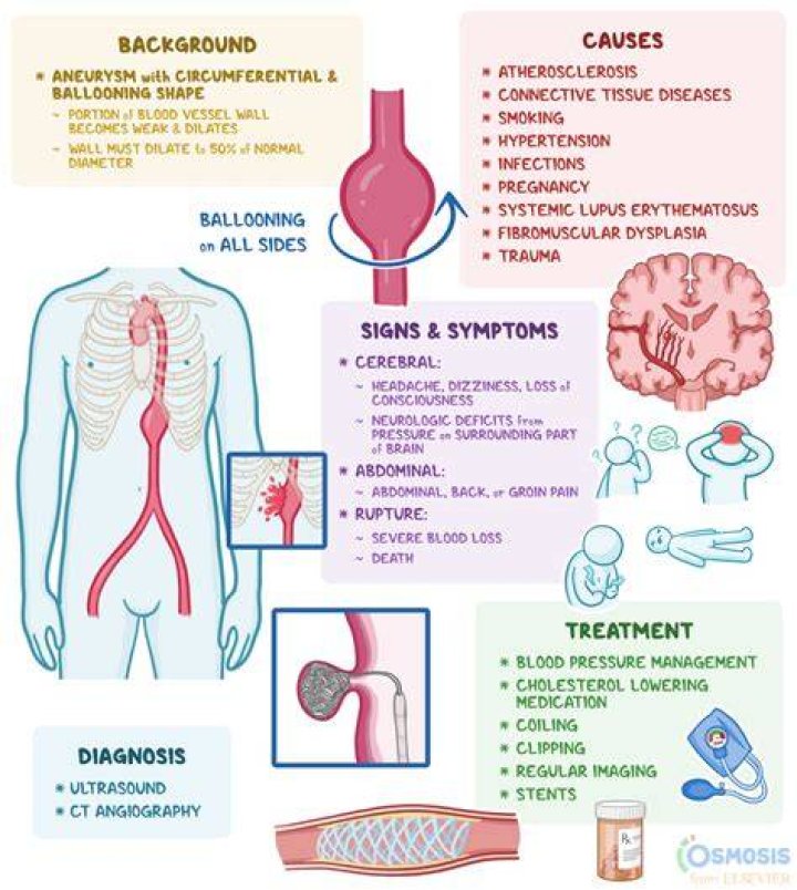 Understanding Hasbulla Disease: Causes, Symptoms, And Treatment