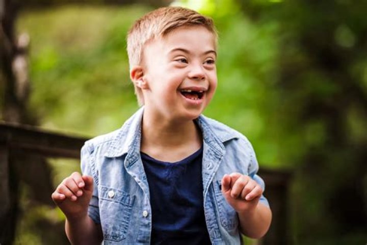 Unraveling The Wonders Of Down Syndrome