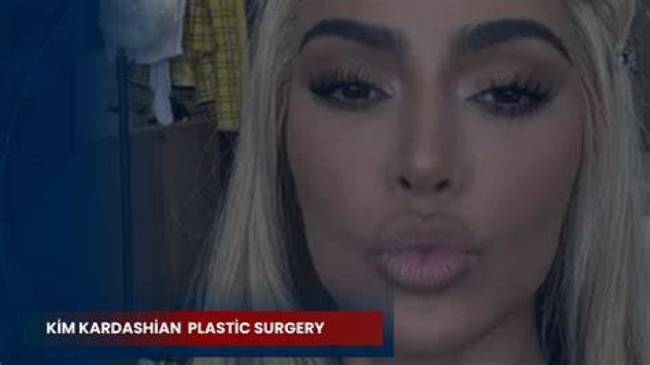 Unveiling Kim Petras' Plastic Surgery Journey: Discoveries And Insights