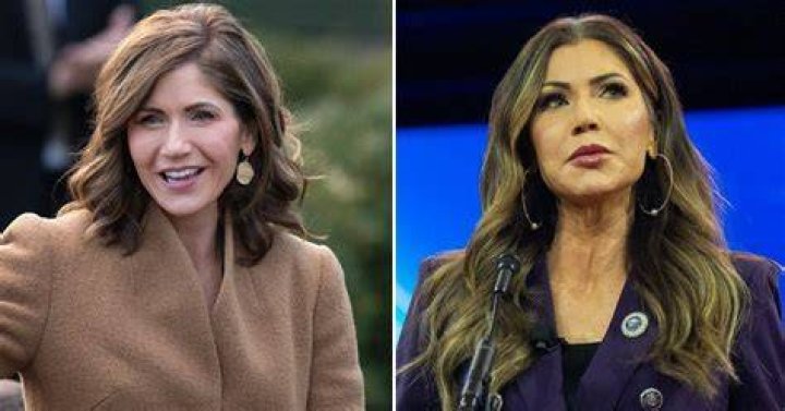 Unveiling The Journey: Kristi Noem's Alleged Plastic Surgery Transformation