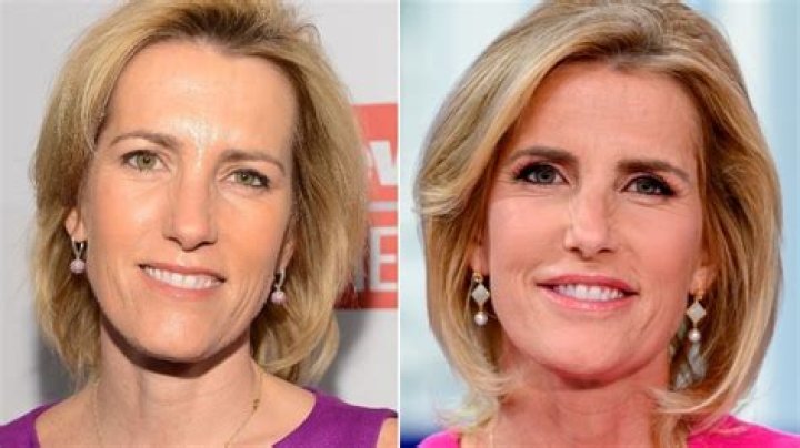 Unveiling The Truth: Exploring Laura Ingraham's Plastic Surgery Journey