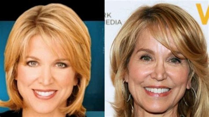 Unveiling The Truth: Paula Zahn's Plastic Surgery Journey Revealed