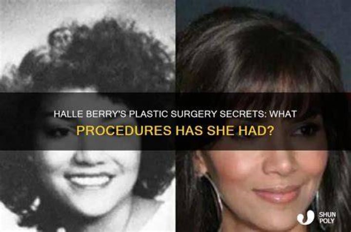 What Procedures Has She Had?