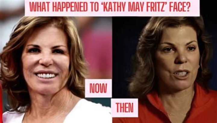 Who Is Kathy May Fritz? Explore Her Face And Facts